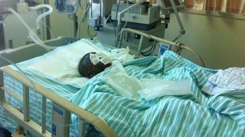 Oğluna benzin i&ccedil;irip yaktı!