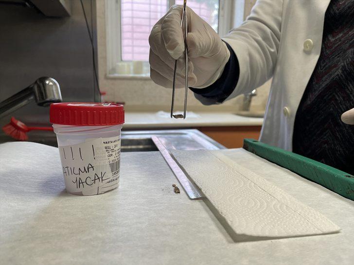 Kanser sanılan hastanın soluk borusundan badem zarı çıkarıldı G3