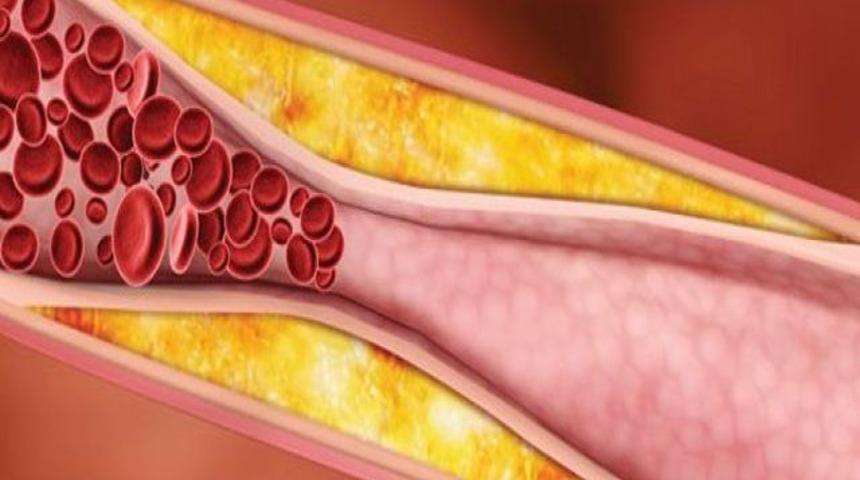 Kolesterolde ezber bozuluyor