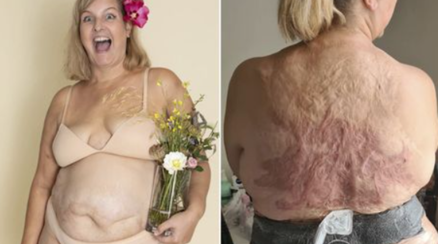 Beden pozitifliği savundu! Paylaşımı olay oldu: Yıllarca kendimi sakladım