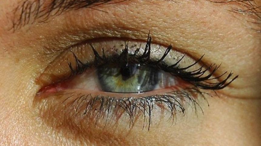 Glokom 50 yaş üzerini vuruyor