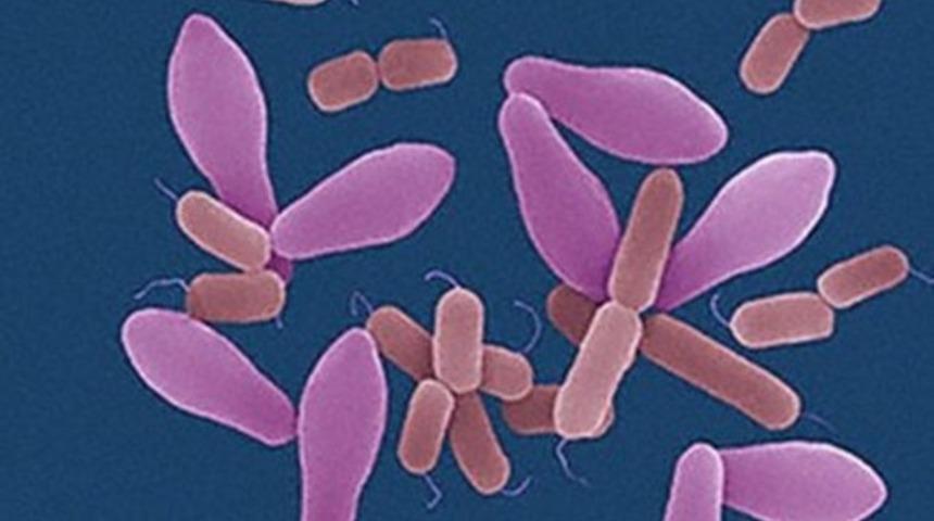 Fournier Gangreni Tedavisi