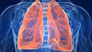 'Bu hastalığa dikkat! Hâlâ ilk 10’da...'