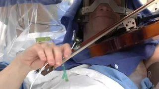 Beyin ameliyatı sırasında keman çaldı