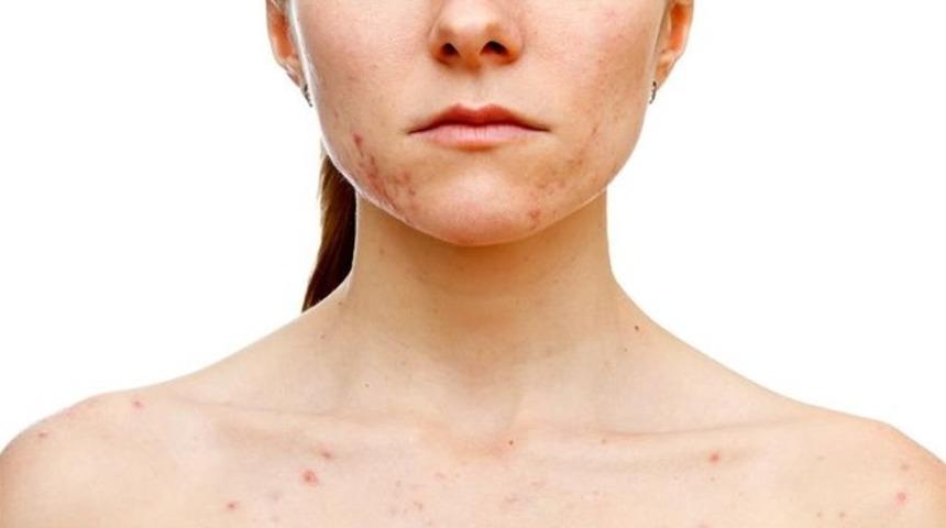 AIDS hastalığının &uuml;rolojik &ouml;nemi ve aids belirtileri