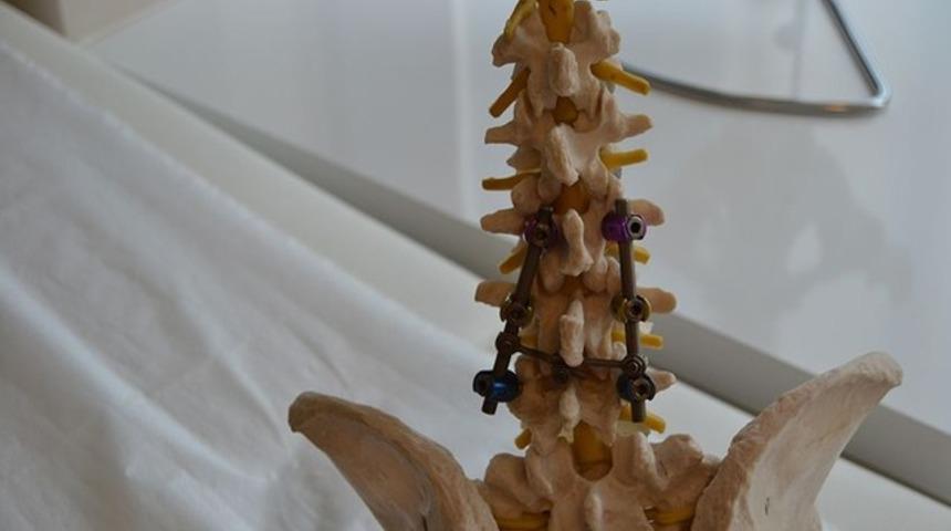 Omurga Kanalı Darlığı Nedir? Omurga Kanalı Darlığı Nedenleri?