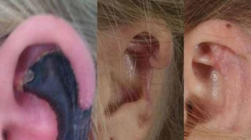 &Ouml;r&uuml;mcek ısırdı kulağı b&ouml;yle oldu