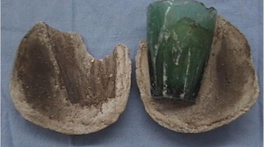 4 yıl bekledi! Cinsel organından çıkan şaşkınlık yarattı, görenler inanamadı