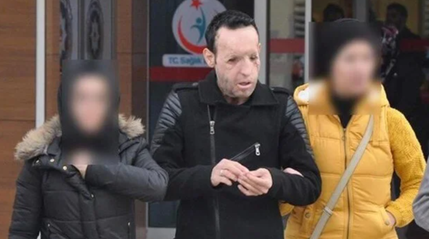 Yüz nakilli Recep Sert uyuşturucudan gözaltına alınmıştı!  'Ben yapmadım, göreceksiniz'