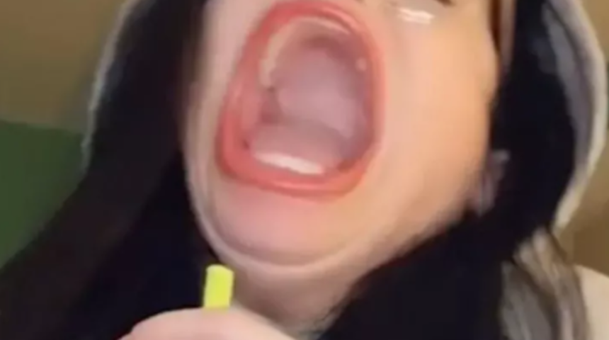 'Dünyanın en büyük ağzına' sahip kadını Samantha Ramsdell, son meydan okumasında yenildi