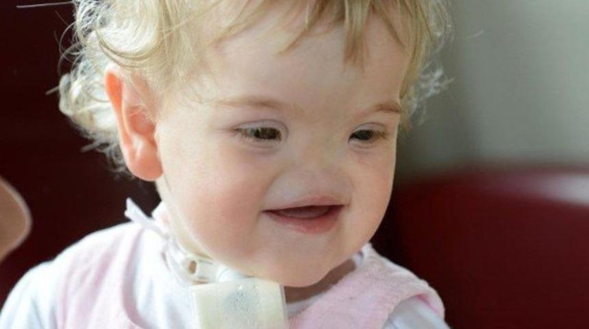 Dünyada sadece 47 kişide var