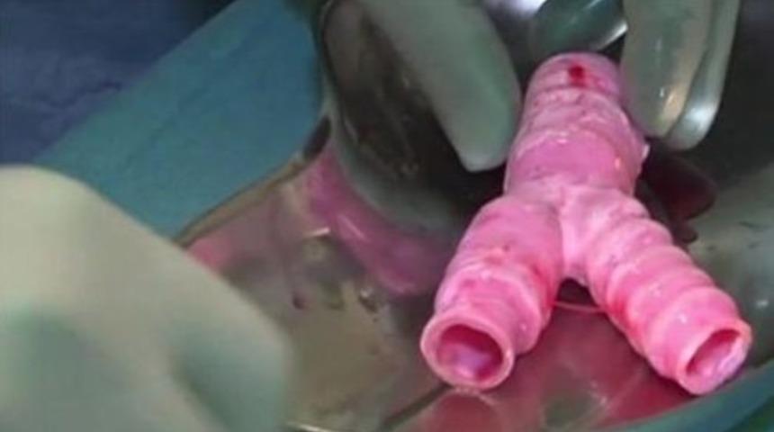 Yapay nefes borusu yapıldı