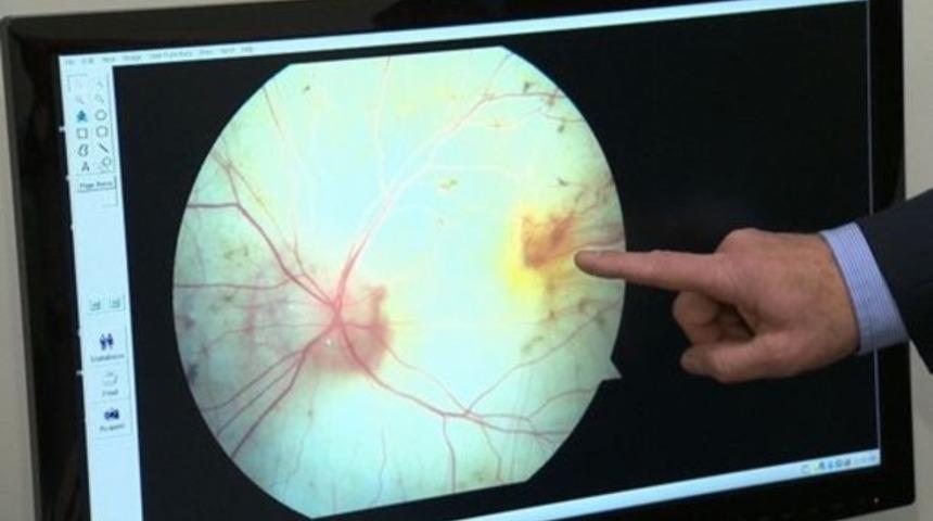 Görme engelliler için yeni umut