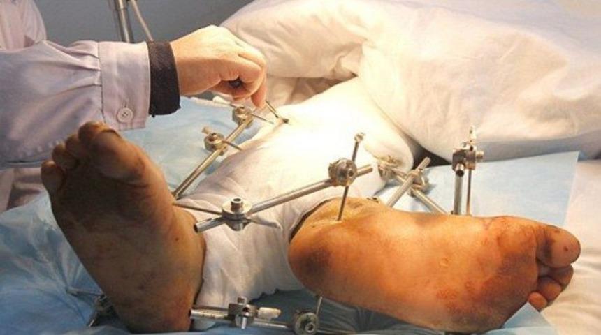 İki tane 'sağ ayağı' var