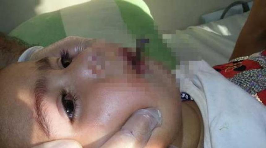 Ağzındaki &ccedil;ivi kafatasına saplandı