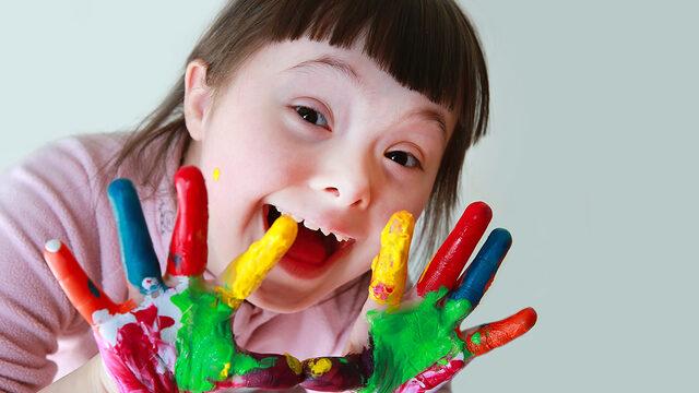 Down sendromuna eşlik eden faktörler arasında… 