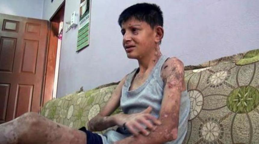 'Artık ben de normal yaşamak istiyorum'