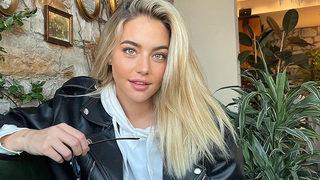 Survivor Aycan Yanaç'ın estetiksiz hali şoke etti! Suratındaki ablaklığa ne oldu abla?