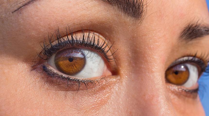 Bunları önlemek göz altı morluklarınızı çözebilir