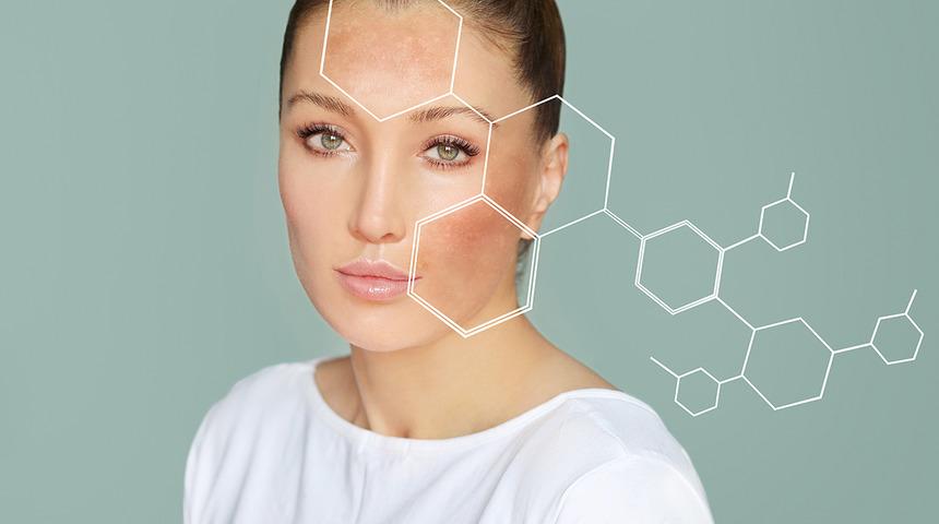 Havuç ile cilt lekelerinden kolayca kurtulabileceğinizi biliyor muydunuz? 