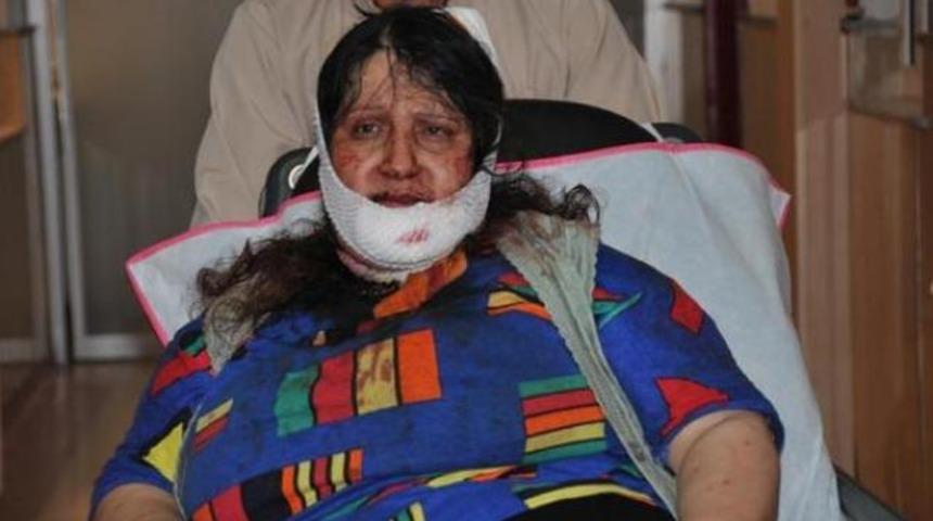 İkinci kez dehşeti yaşadı!