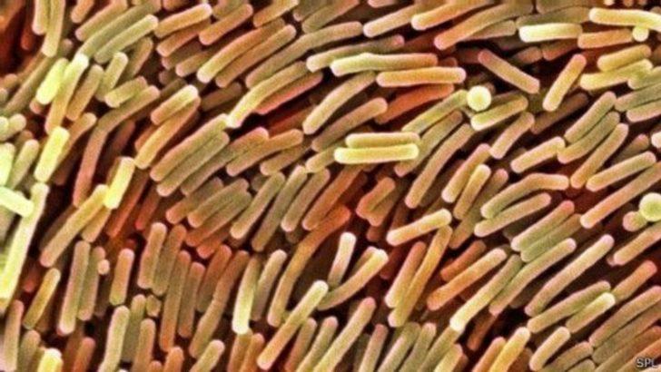 Alerjiye karşı koruyan bakteri: Clostridium