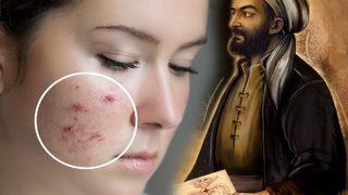 İbn-i Sina tek tek açıkladı! Kökünden kurutuyor