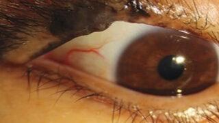 Şoke edici görüntü! Bu detay kanser habercisi