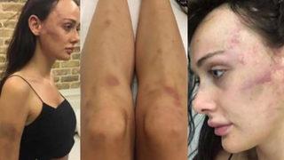 Sırp model Tanja Ortaköy'de kabusu yaşamıştı! Yönetmen sevgiliye 9 ay hapis