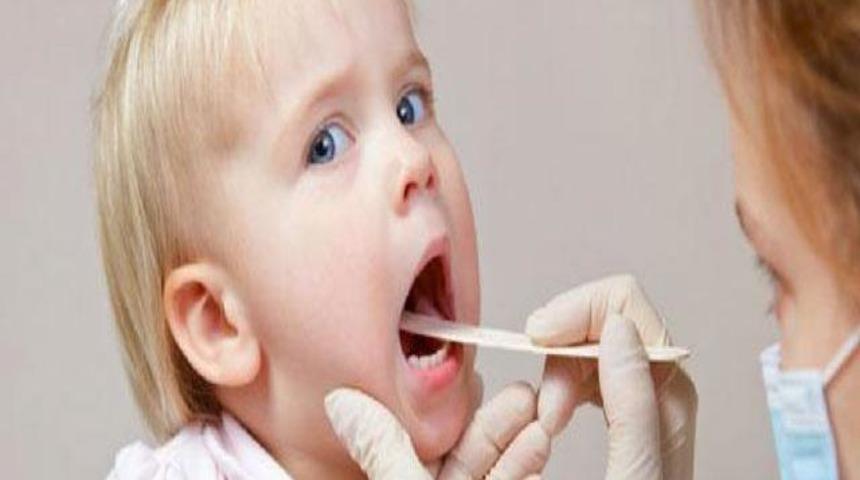 Bademcik iltihabı geçiren çocuklara dikkat!