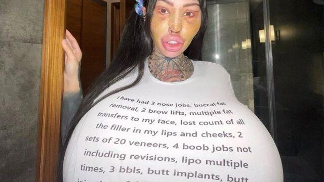 Dünyanın en büyük vajinasına sahip olmak için defalarca kez ameliyat oldu! Son işlemlerden sonra kimse tanıyamadı