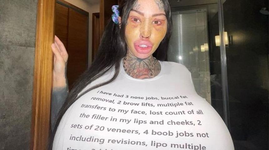 Dünyanın en büyük vajinasına sahip olmak için defalarca kez ameliyat oldu! Son işlemlerden sonra kimse tanıyamadı