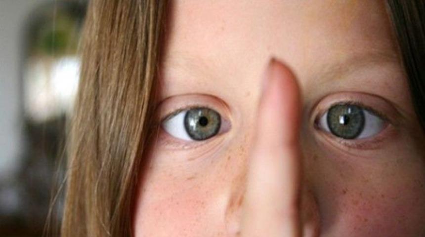 Fotoğraftan şaşılık testi