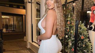 Love Island’ın yıldızı Anna Vakili popo ameliyatı için Türkiye'ye geldi! Öleceğimi sandım