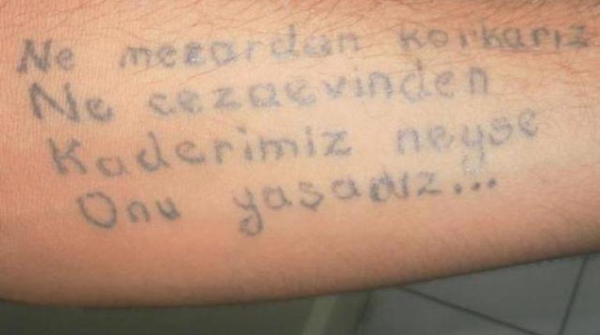 Kolundaki d&ouml;vme polisi bile şaşırttı