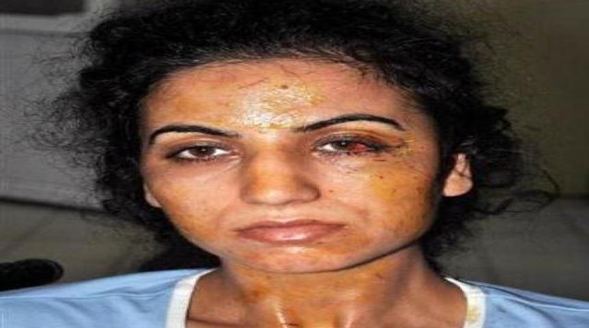 T&uuml;m gece d&ouml;v&uuml;ld&uuml;, sandalyede polise gitti