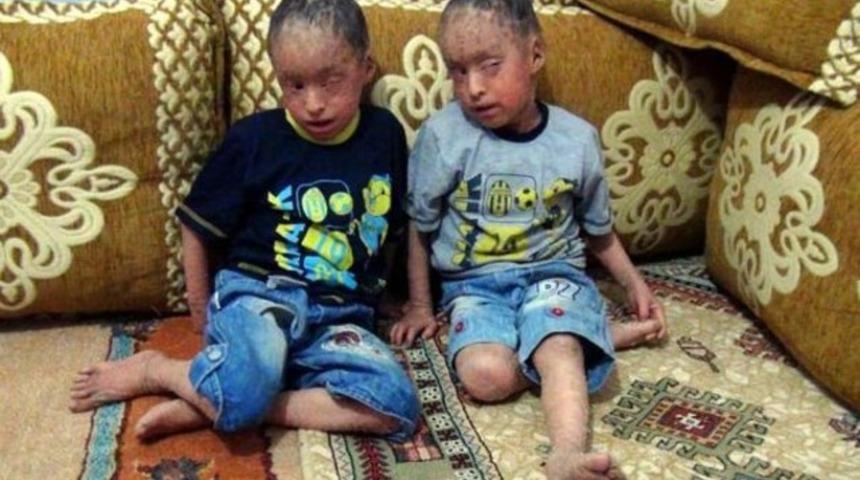 Gözleri dikilmişti şimdi o günü bekliyorlar