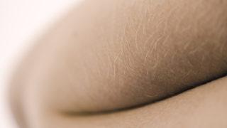 Ağrı, şişlik, akıntı... Kıl dönmesi nedir, belirtileri nelerdir? Kıl dönmesi tedavi edilmezse ne olur?