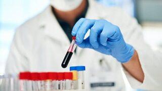 İlk kez insan kanında mikroplastik tespit edildi