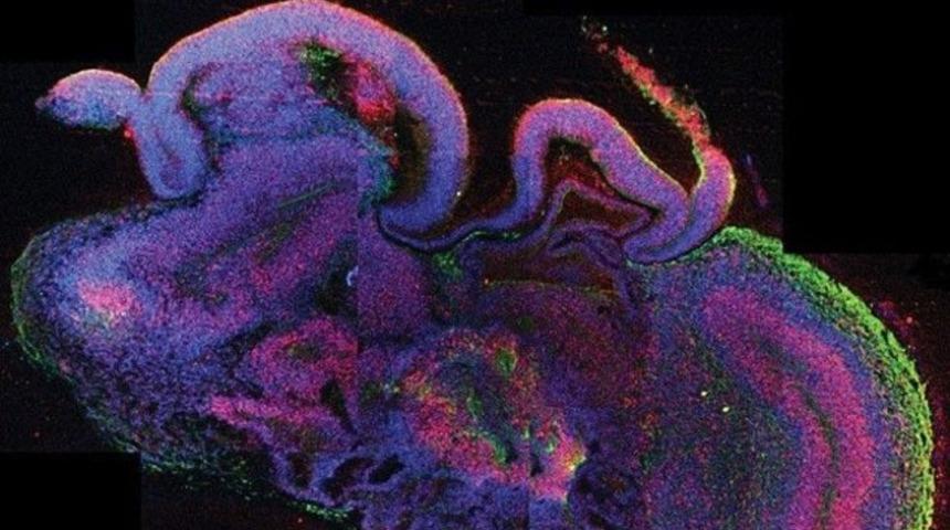 Bilincin "açma/kapama düğmesi" bulundu