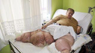 400 kiloluk fil hastası yardım bekliyor