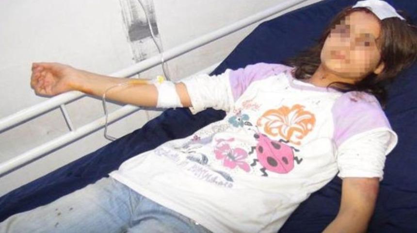 Üvey annesi öldüresiye dövdü!