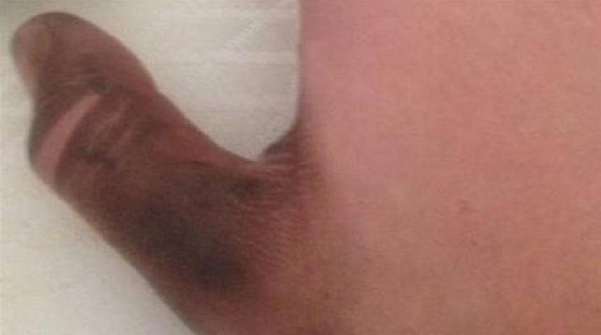 iPad şarjı elinde patladı