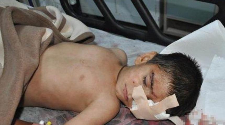 6 yaşındaki çocuk gaz kapsülü ile yaralandı