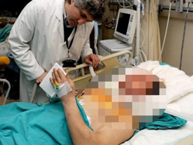 Ameliyatı yapan doktor ilk kez konuştu 1