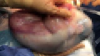 Doktorları şoke eden nadir doğum! İçimden çığlıklar atıyordum