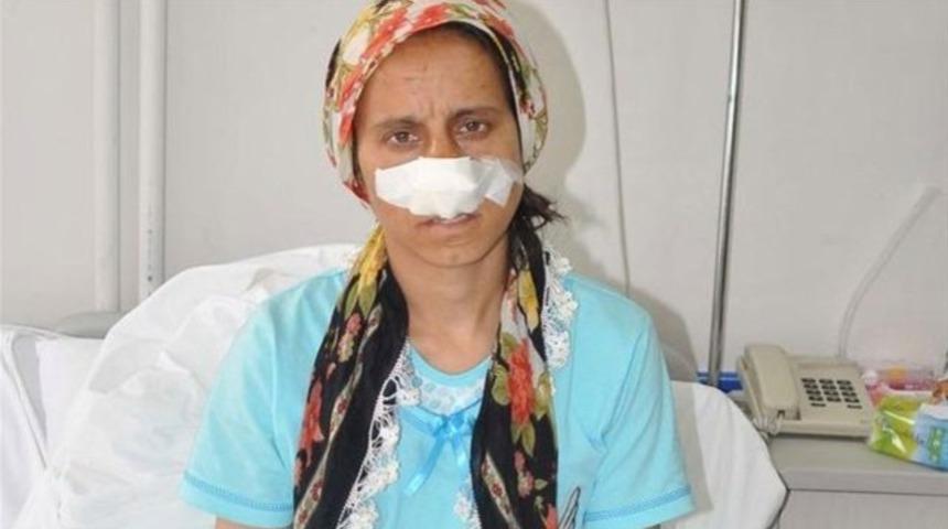 Kadına şiddette son nokta