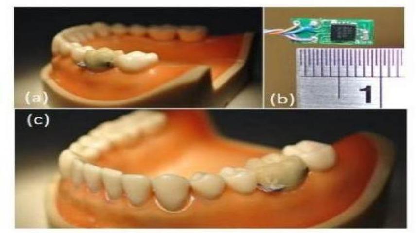 &Ccedil;ok &ouml;nemli bir buluş