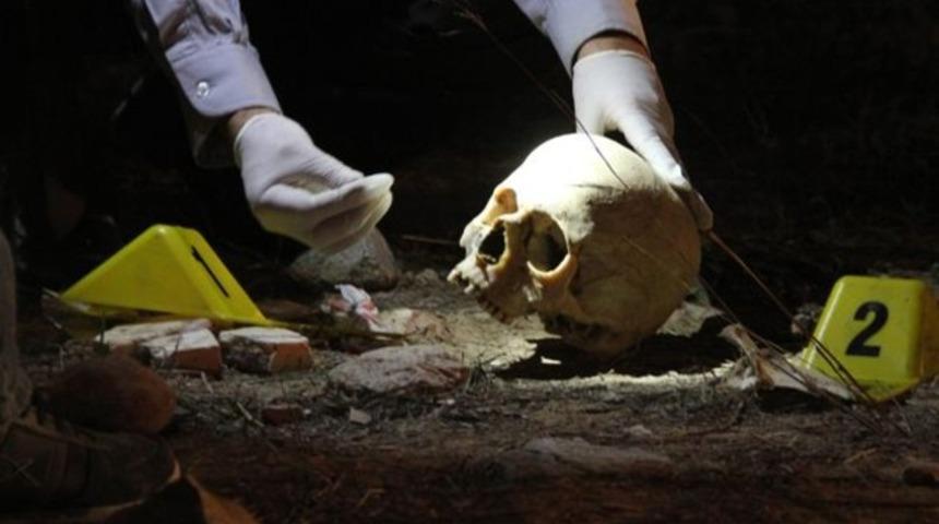 Polis, kafatasının sırrını takma dişten çözdü