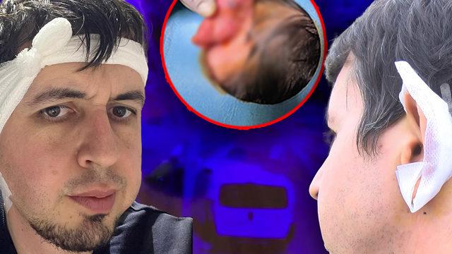 Hayatının kâbusunu yaşadığı anlar kamerada! Belki de beni parçalayacaklardı 